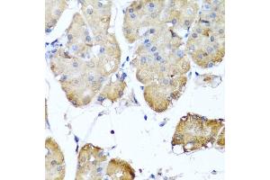 Immunohistochemistry of paraffin-embedded human stomach using NIN antibody (ABIN6129422, ABIN6144630, ABIN6144632 and ABIN6224239) at dilution of 1:100 (40x lens). (Ninein anticorps  (AA 1-287))