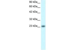 Western Blotting (WB) image for anti-MAX Dimerization Protein 4 (MXD4) antibody (ABIN2460569) (MXD4 anticorps)
