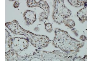 Immunoperoxidase of monoclonal antibody to RBM9 on formalin-fixed paraffin-embedded human placenta.