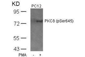 Western blot analysis of extracts from PC12 cells untreated or treated with PMA using PKCd(Phospho-Ser645) Antibody.