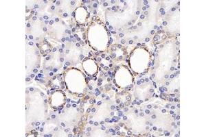 Immunohistochemistry analysis of paraffin-embedded rat kidney using,TSPAN1 (ABIN7075867) at dilution of 1: 4000