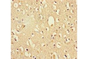 Immunohistochemistry of paraffin-embedded human brain tissue using ABIN7164380 at dilution of 1:100