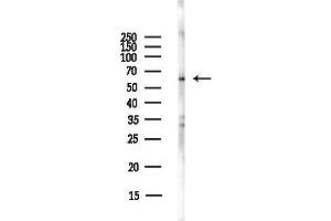 Western blot analysis of lysates from Hela cells(starvation,24h treatment), using FZ Antibody at 1/1000 dilution.