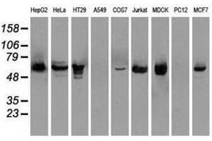 Image no. 3 for anti-Checkpoint Kinase 2 (CHEK2) antibody (ABIN1497500) (CHEK2 anticorps)