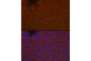 Immunofluorescence analysis of mouse liver cells using ApoB Rabbit pAb (ABIN3015447, ABIN3015448, ABIN5663872 and ABIN6217244) at dilution of 1:100 (40x lens).