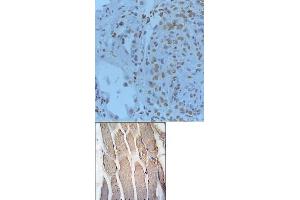Image no. 2 for anti-Gremlin 1 (GREM1) (C-Term) antibody (ABIN358612) (GREM1 anticorps  (C-Term))