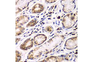 Immunohistochemistry of paraffin-embedded human colon using RPN1 antibody at dilution of 1:100 (x40 lens). (RPN1 anticorps)