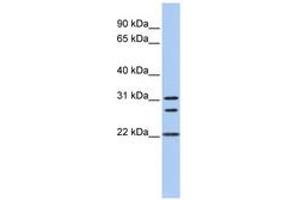 Image no. 1 for anti-Calponin (N-Term) antibody (ABIN6743468) (Calponin anticorps  (N-Term))