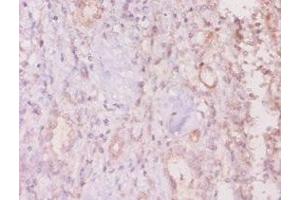 Immunohistochemistry of paraffin-embedded human kidney tissue using ABIN7160281 at dilution of 1:20 (MUC16 anticorps  (AA 14067-14328))