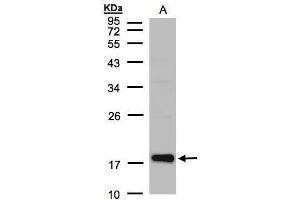 WB Image Sample(30 μg of whole cell lysate) A:Raji , 12% SDS PAGE antibody diluted at 1:1000 (Cofilin 2 anticorps  (C-Term))