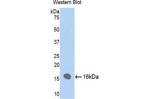 Detection of Recombinant FABP4, Human using Polyclonal Antibody to Fatty Acid Binding Protein 4 (FABP4)