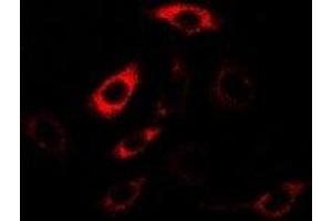 Immunofluorescent analysis of HPPDase staining in U2OS cells.