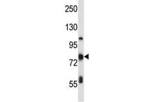 TP63 antibody western blot analysis in MDA-MB231 lysate.