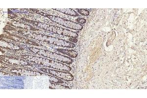 Immunohistochemistry of paraffin-embedded Human colon tissue using CK-8 Monoclonal Antibody at dilution of 1:200. (KRT8 anticorps)