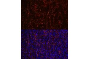 Immunofluorescence analysis of human spleen using CD23 Rabbit mAb (ABIN7267160) at dilution of 1:100 (40x lens).