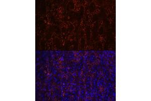 Immunofluorescence analysis of human spleen using CD23 Rabbit mAb (ABIN7267160) at dilution of 1:100 (40x lens).