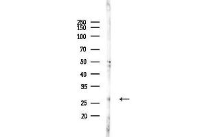 Western blot analysis of lysates from EC304 cells(heat-shock,45 min treatment), using SR Antibody at 1/1000 dilution.