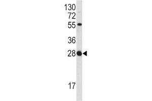 Western Blotting (WB) image for anti-Fibroblast Growth Factor 18 (FGF18) antibody (ABIN3002728) (FGF18 anticorps)