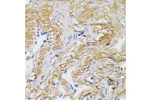 Immunohistochemistry of paraffin-embedded mouse kidney using WNT3A Rabbit pAb (ABIN3021018, ABIN3021019, ABIN3021020, ABIN1513690 and ABIN6213915) at dilution of 1:150 (40x lens).