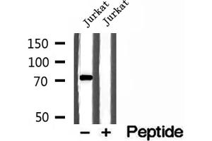 Western blot analysis of extracts of Jurkat cells, using MTO1 antibody. (MTO1 anticorps  (N-Term))