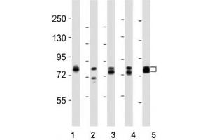 Western blot testing of DNM1L antibody at 1:8000 dilution and lysate from: 1: rat PC12