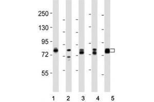Western blot testing of DNM1L antibody at 1:8000 dilution and lysate from: 1: rat PC12 (Dynamin 1-Like anticorps  (C-Term))