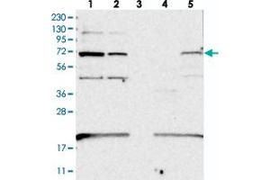 Western blot analysis of Lane 1: RT-4, Lane 2: U-251 MG, Lane 3: Human Plasma, Lane 4: Liver, Lane 5: Tonsil with EEFSEC polyclonal antibody  at 1:250-1:500 dilution.