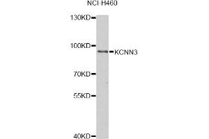 Western blot analysis of extracts of NCI-H460 cells, using KCNN3 antibody. (KCNN3 anticorps)