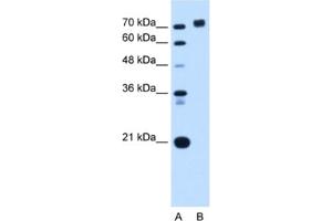 Western Blotting (WB) image for anti-Protein Tyrosine Phosphatase, Receptor Type, N (PTPRN) antibody (ABIN2462847) (PTPRN anticorps)