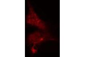 ABIN6275516 staining  NIH-3T3 cells by IF/ICC.