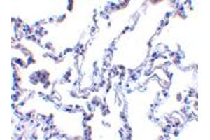 Immunohistochemistry of RRM2B in human lung tissue with RRM2B polyclonal antibody  at 1 ug/mL . (RRM2B anticorps  (AA 2-17))