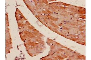 Immunohistochemistry of paraffin-embedded human skeletal muscle tissue using ABIN7143128 at dilution of 1:100 (Actin anticorps  (AA 3-377))