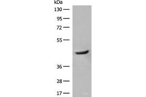 Western blot analysis of Human fetal liver tissue lysate using GCAT Polyclonal Antibody at dilution of 1:400 (GCAT anticorps)