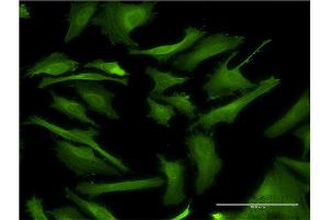 Immunofluorescence of monoclonal antibody to DAPK2 on HeLa cell. (DAPK2 anticorps  (AA 281-370))