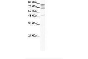 Image no. 1 for anti-DEAD (Asp-Glu-Ala-Asp) Box Polypeptide 46 (DDX46) (C-Term) antibody (ABIN202967) (DDX46 anticorps  (C-Term))