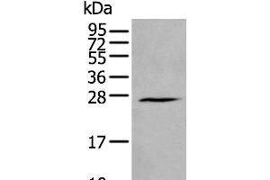 Western blot analysis of Human fetal brain tissue lysate using HAND1 Polyclonal Antibody at dilution of 1:400 (HAND1 anticorps)