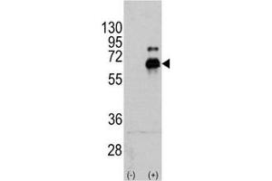 Western blot analysis of p70S6K antibody and 293 cell lysate (2 ug/lane) either nontransfected (Lane 1) or transiently transfected with the RPS6KB1 gene (2).