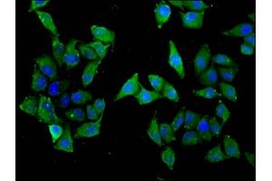 Immunofluorescence staining of Hela cells with ABIN7170160 at 1:33, counter-stained with DAPI. (SLC22A5 anticorps  (AA 42-142))