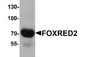 Western blot analysis of FOXRED2 in human lung tissue lysate with FOXRED2 antibody at 1 µg/mL.