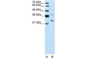 WB Suggested Anti-DCUN1D1 Antibody Titration:  0. (DCUN1D1 anticorps  (N-Term))