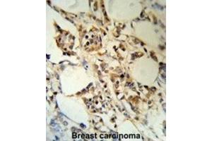 Immunohistochemistry (IHC) image for anti-RNA Binding Motif Protein 3 (RBM3) antibody (ABIN3003187)