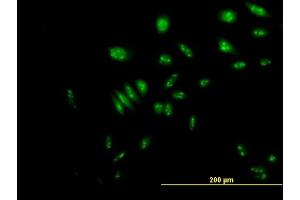 Immunofluorescence of purified MaxPab antibody to NVL on HeLa cell. (NVL anticorps  (AA 1-659))