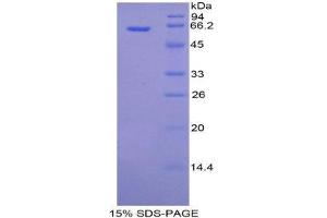 SDS-PAGE (SDS) image for alpha-Fetoprotein (AFP) (AA 31-576) protein (His tag,SUMO Tag) (ABIN1877836) (alpha Fetoprotein Protein (AA 31-576) (His tag,SUMO Tag))