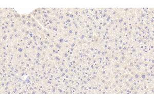 Detection of a1BG in Mouse Liver Tissue using Polyclonal Antibody to Alpha-1-B-Glycoprotein (a1BG)