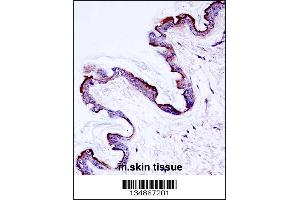 Mouse Prkch Antibody immunohistochemistry analysis in formalin fixed and paraffin embedded mouse skin tissue followed by peroxidase conjugation of the secondary antibody and DAB staining. (PKC eta anticorps  (AA 314-341))