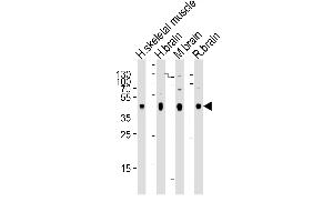 Western blot analysis of lysates from human skeletal muscle, human brain, mouse brain, rat brain tissue (from left to right), using PDK2 Antibody (ABIN659060 and ABIN2838063). (PDK2 anticorps)