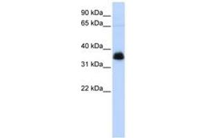 Image no. 1 for anti-Aryl Hydrocarbon Receptor Interacting Protein (AIP) (AA 36-85) antibody (ABIN6744248) (AIP anticorps  (AA 36-85))