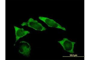 Immunofluorescence of purified MaxPab antibody to IMP-2 on HeLa cell. (IGF2BP2 anticorps  (AA 1-598))