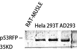 Western Blot (WB) analysis of specific cells using p53RFP Polyclonal Antibody. (RNF144B anticorps  (Internal Region))