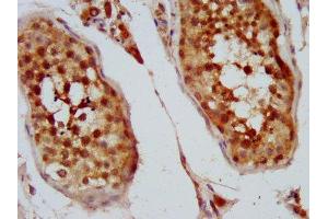 IHC image of ABIN7157575 diluted at 1:400 and staining in paraffin-embedded human testis tissue performed on a Leica BondTM system.